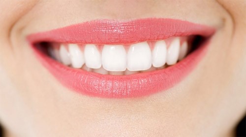  Răng sứ Zirconia không bị đen viền 