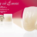 Răng sứ Emax press images internet